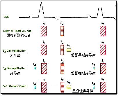 奔馬律|奔馬律心音症状,奔馬律心音的治療